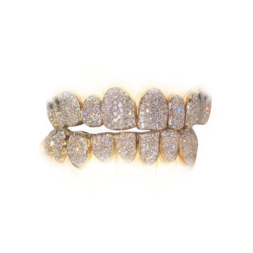 18K (16) VVS Diamond Grillz (PERM CUT)